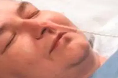 Saúde Home Care - Trocas de Sonda Vesical de Demora e Sonda Nasoenteral